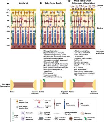 Neuroinflammation, Microglia and Implications for Retinal Ganglion Cell Survival and Axon Regeneration in Traumatic Optic Neuropathy